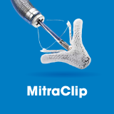 MitraClip