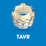 TAVR 